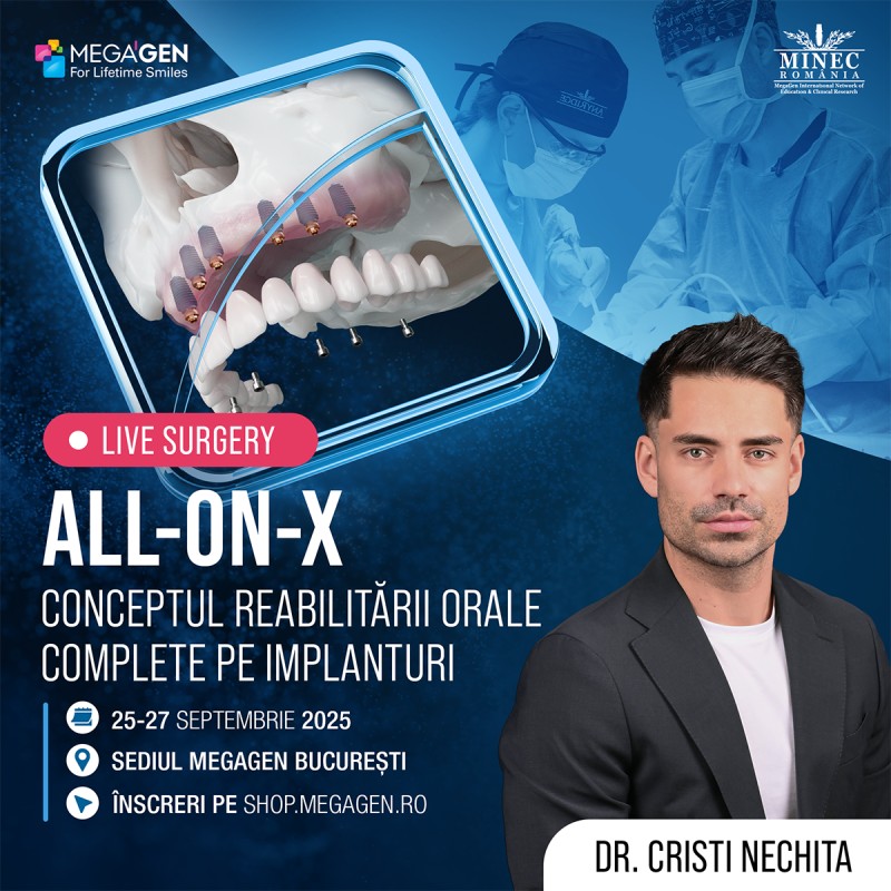 All-on-X - Conceptul reabilitarii orale complete pe implanturi