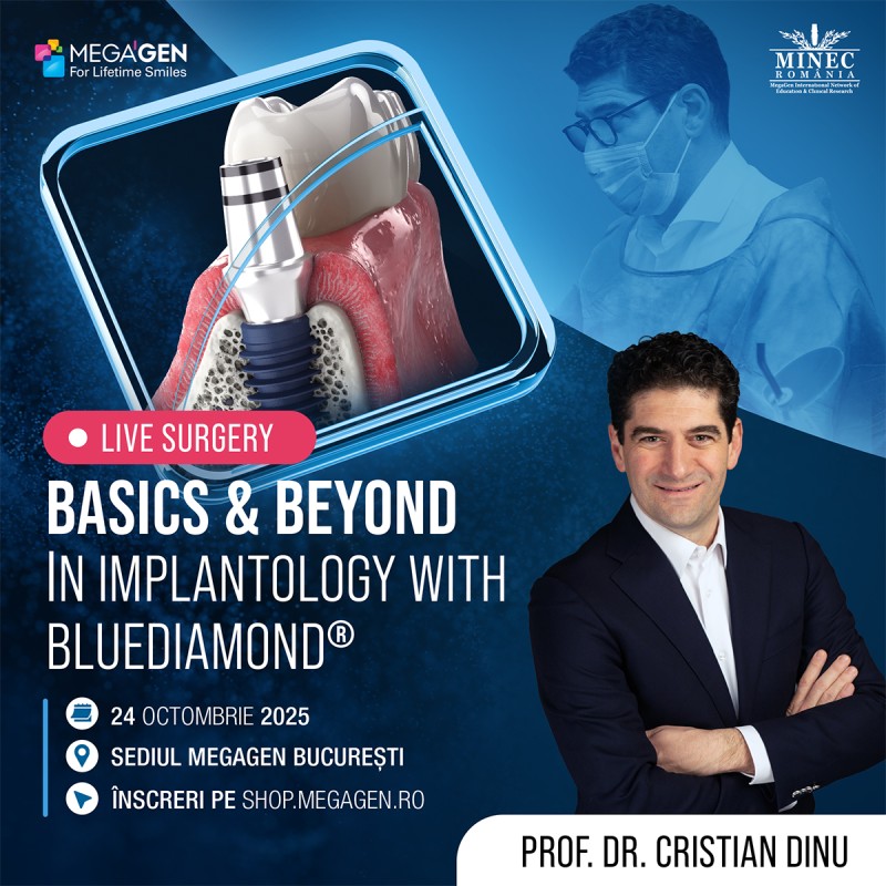 Basics & Beyond in Implantology with BLUEDIAMOND® Implant