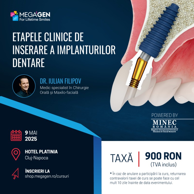 Etapele clinice de inserare a implanturilor dentare