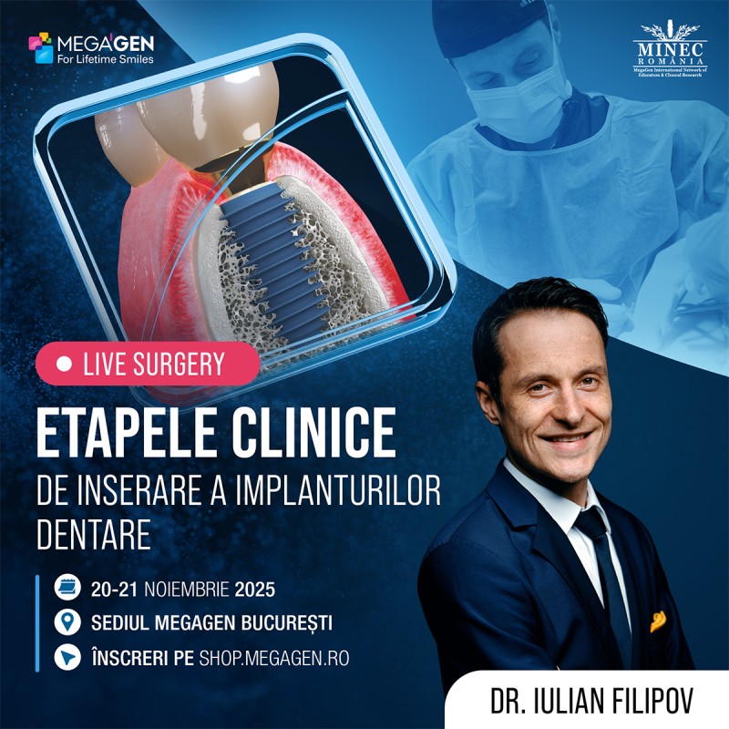 LIVE SURGERY: Etapele Clinice de Inserare a Implanturilor Dentare