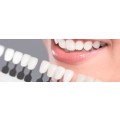 Piesa de mana Epic Whitening, pentru albirea cu laserele cu Dioda de la Biolase