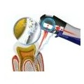 Aparat profilaxie Vector Paro Pro Dürr Dental