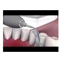 Aparat profilaxie Vector Paro Pro Dürr Dental